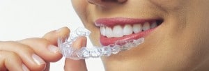  invisalign