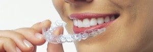 יישור שיניים שקוף בשיטת אינויזליין