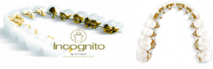 יישור שיניים פנימי בשיטת INCOGNITO (אינקוגניטו)