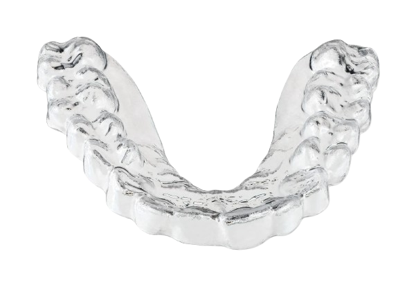 גשר שקוף - מה חשוב לדעת