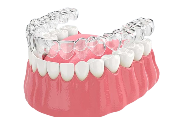 כללים להתנהלות עם קשתיות שקופות